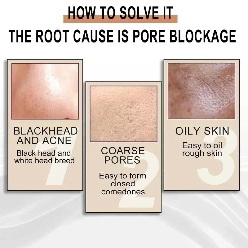 Lactobionic Acid Pore Shrinking Serum Repairing Tightening Face Serum Moisturizing Oil Control Skin Care Korean Cosmetic