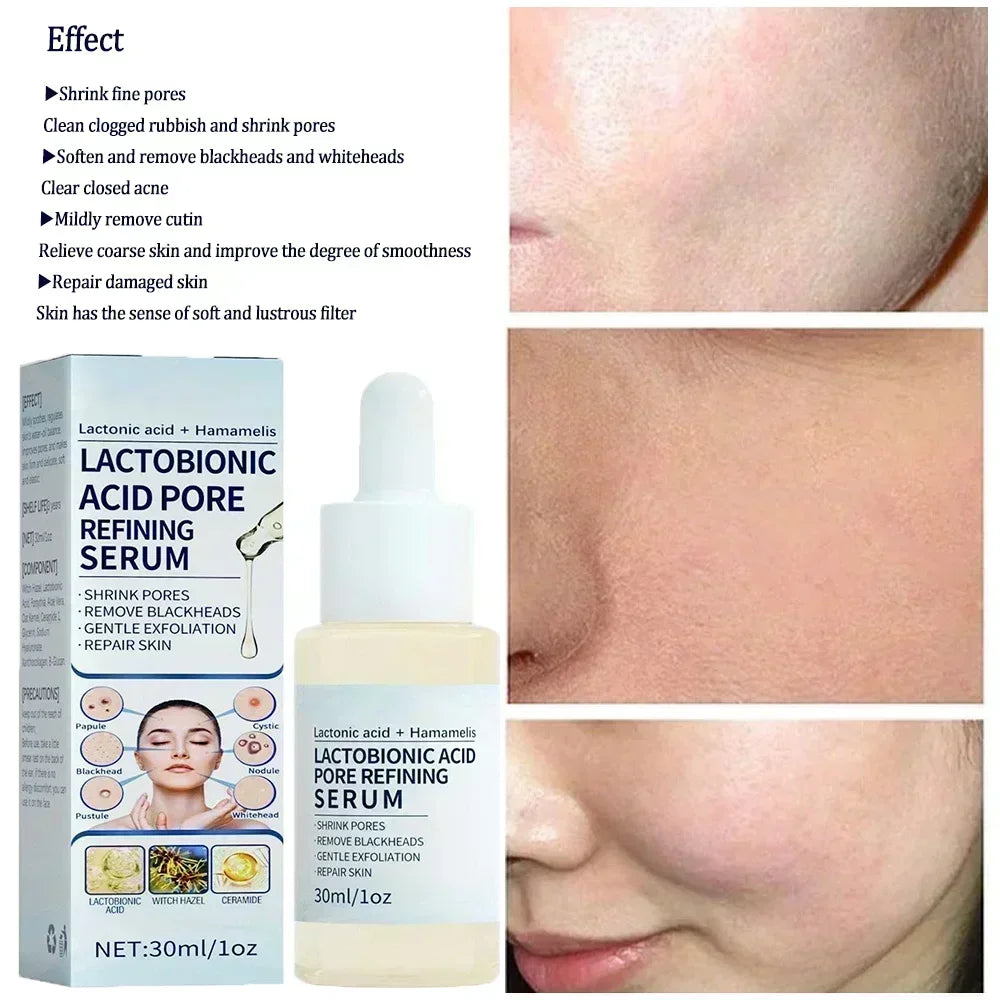 Lactobionic Acid Pore Shrinking Serum Repairing Tightening Face Serum Moisturizing Oil Control Skin Care Korean Cosmetic